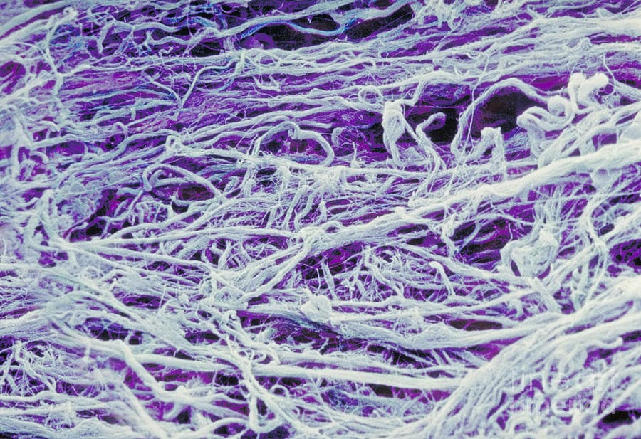 Microscope image of collagen fibers, showing the fibrillar scaffolding that collagenase clears