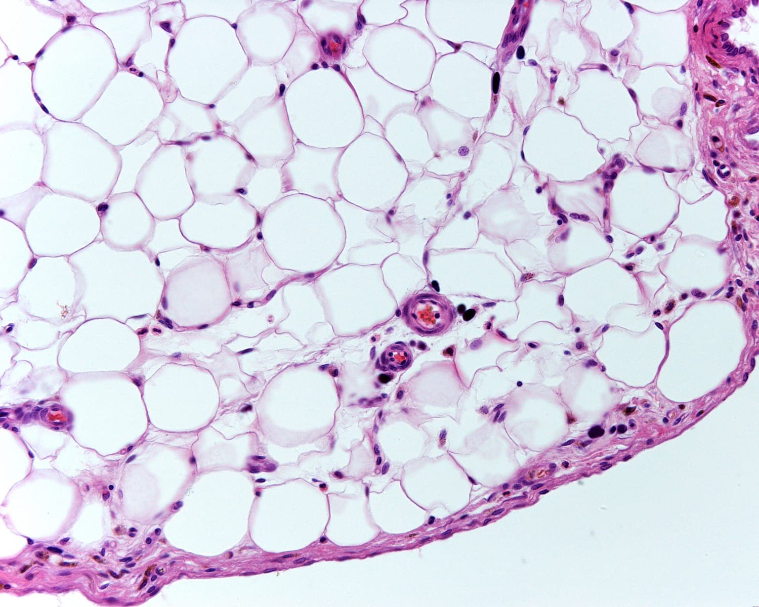 H&E-stained histological section of adipose tissue showing the characteristic honeycomb pattern of fat cells that lipase targets