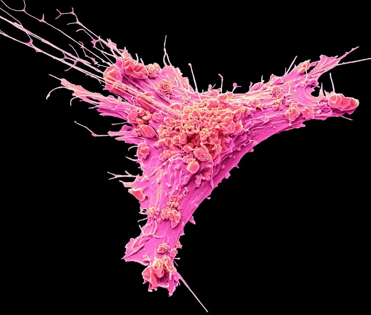 Colorized scanning electron micrograph of a single fibroblast with extended filopodia — the collagen-making cell anchored and spreading, ready to produce new collagen