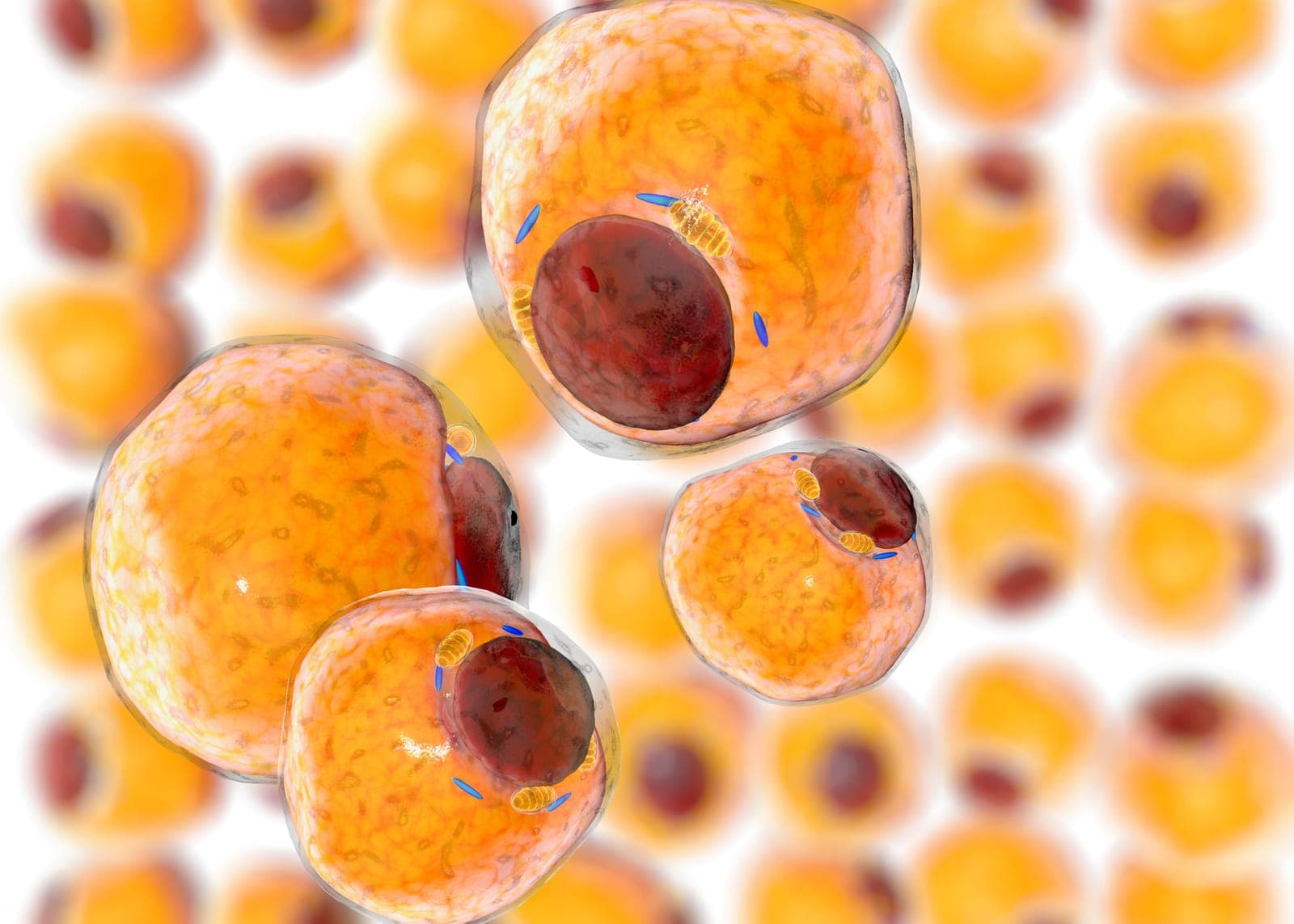 3D rendered illustration of adipocytes (fat cells) showing the large orange lipid droplets and dark red nuclei