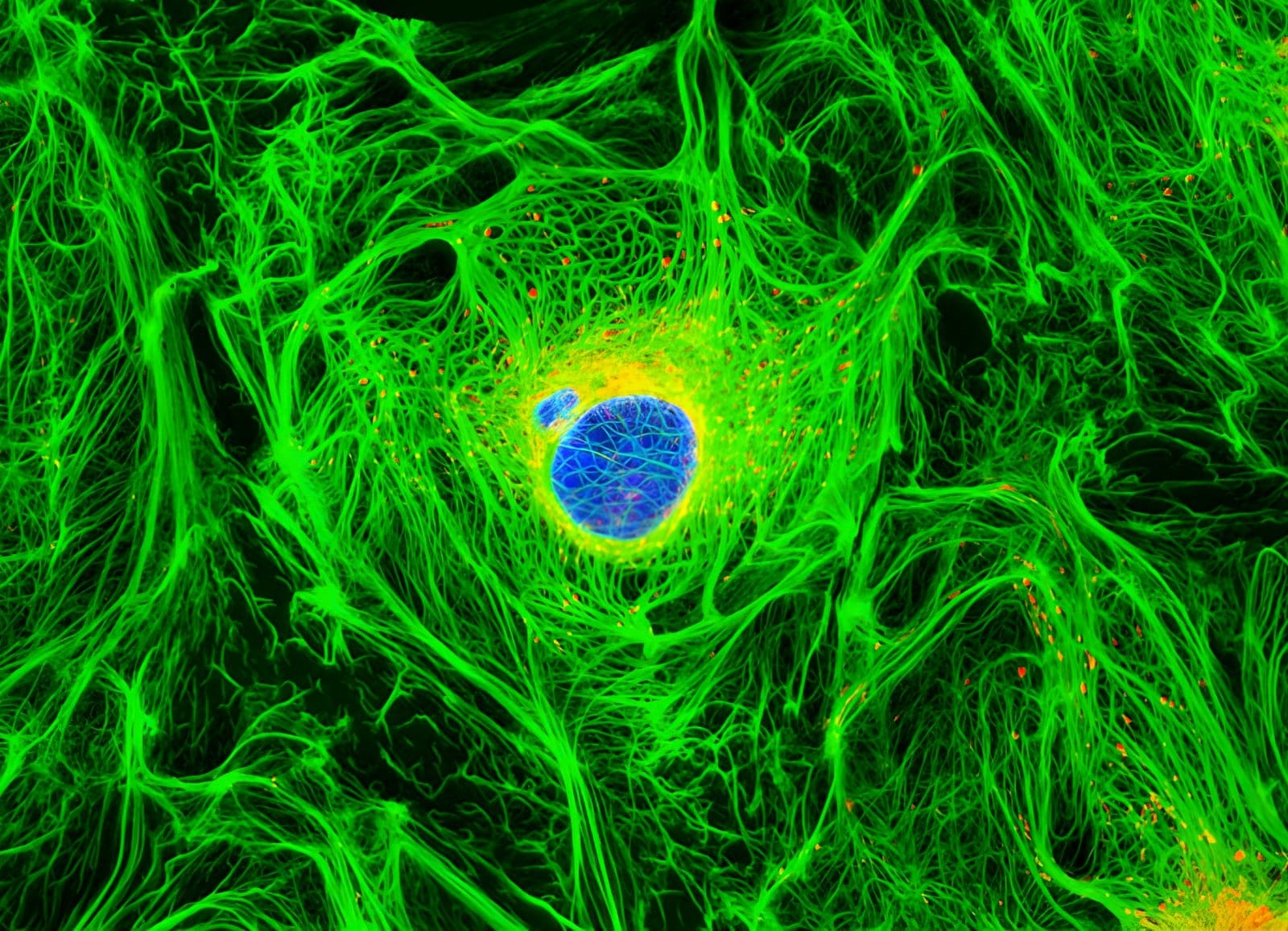 Fluorescence microscopy of a single cell with radiating green cytoskeletal fibers and a blue nucleus — a fully spread, anchored cell in a healthy matrix