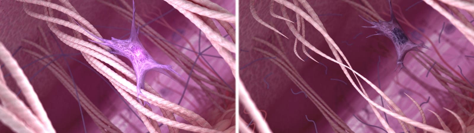 3D illustration comparing young dermal matrix (left — thick collagen, healthy fibroblast) with aged dermal matrix (right — thinner fibers, smaller fibroblast)