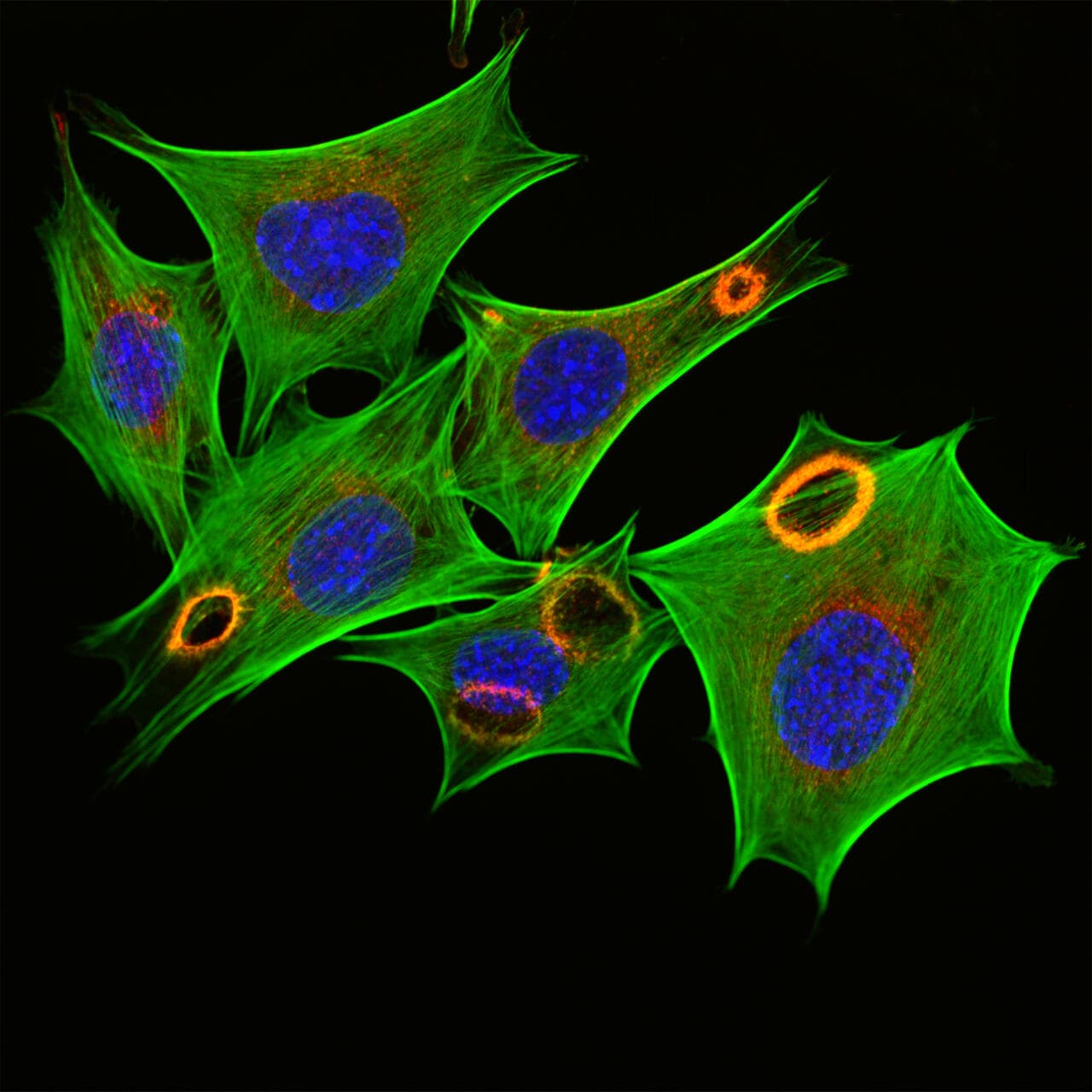 Fluorescence microscopy of fibroblast cells — blue nuclei, green actin cytoskeleton, orange focal adhesions