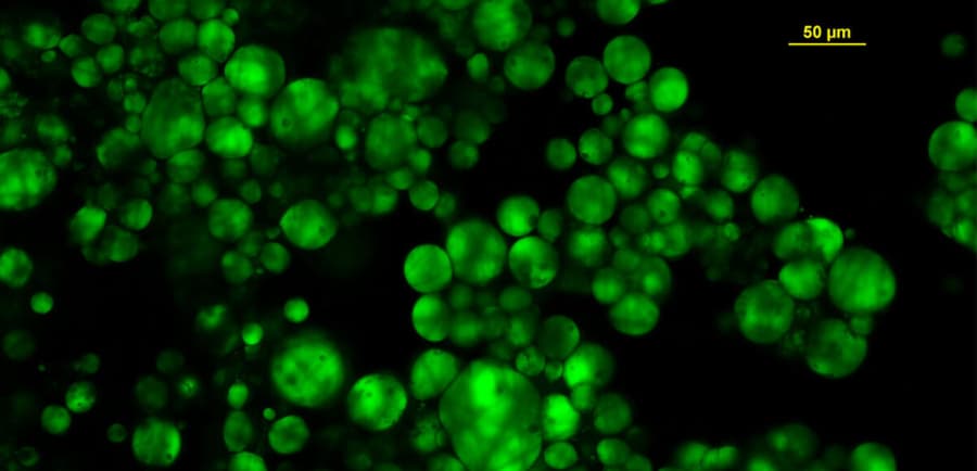 Fluorescence microscopy showing large green lipid droplets in an adipose tissue model — the triglyceride stores that lipase targets