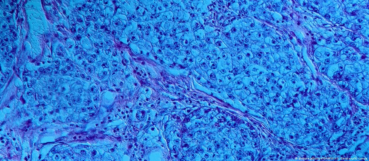 Alcian blue stained histological slide showing glycosaminoglycans and proteoglycans — the sulfated sugars that lyase targets